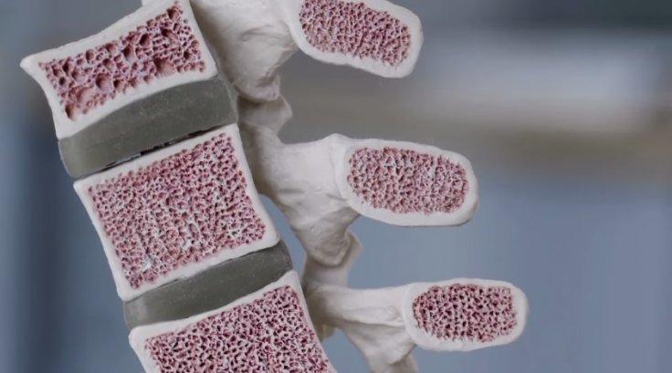  Microlattice o metal mais leve do mundo